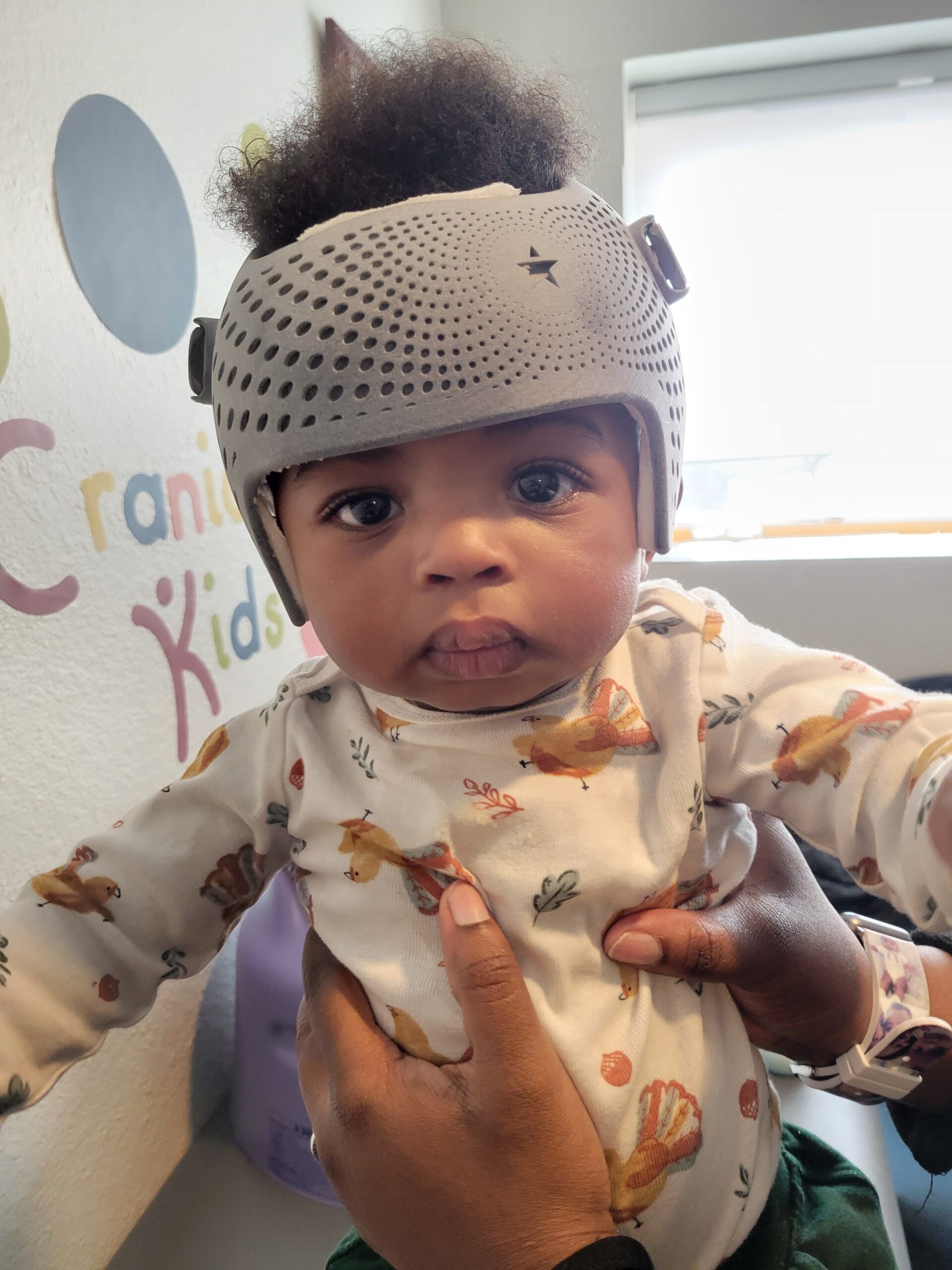 Plagiocephaly Treatment by Cranial Kids