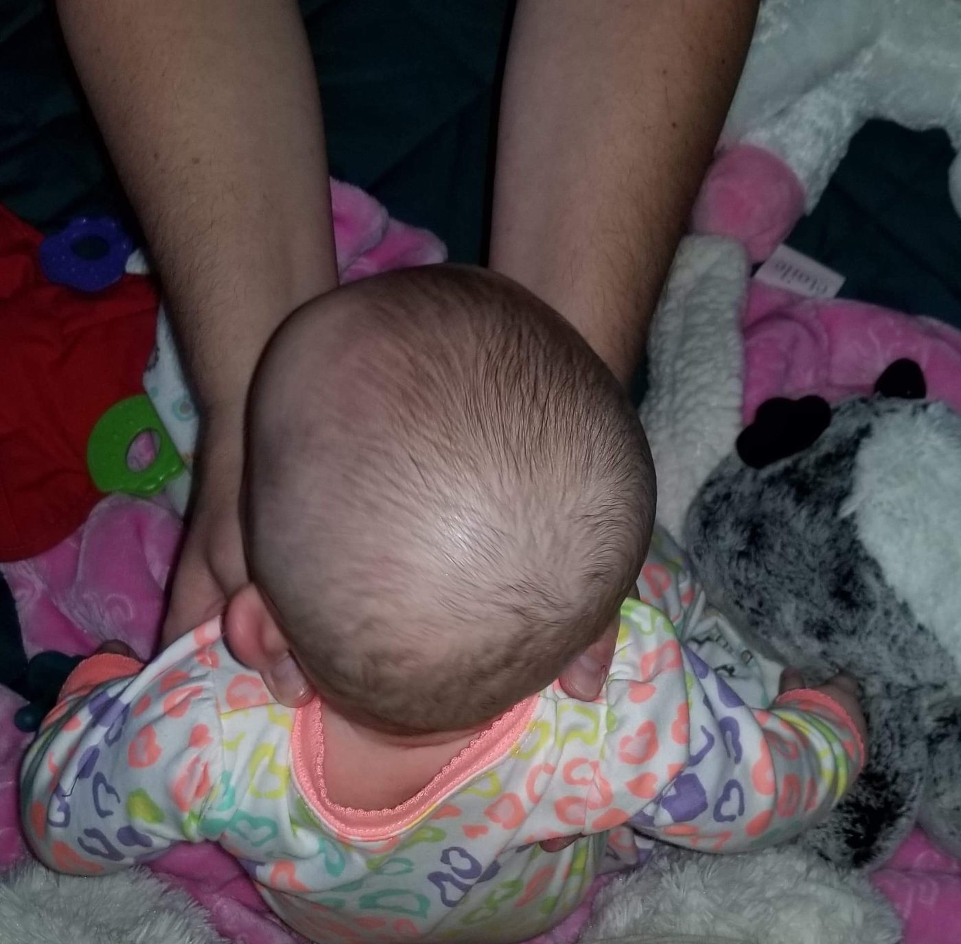 Olivia during helmet treatment